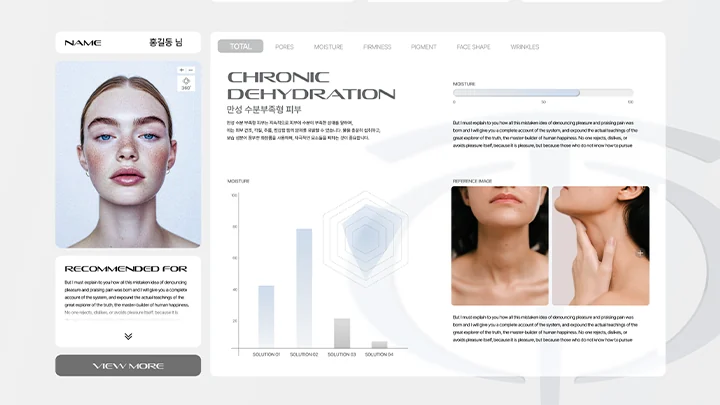 AI REPORT — 리포트